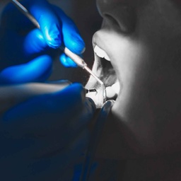 Revisión detallada con espejo dental en Clínica SanAngel