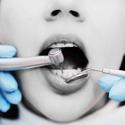 Uso de instrumental rotatorio en tratamiento dental en SanAngel